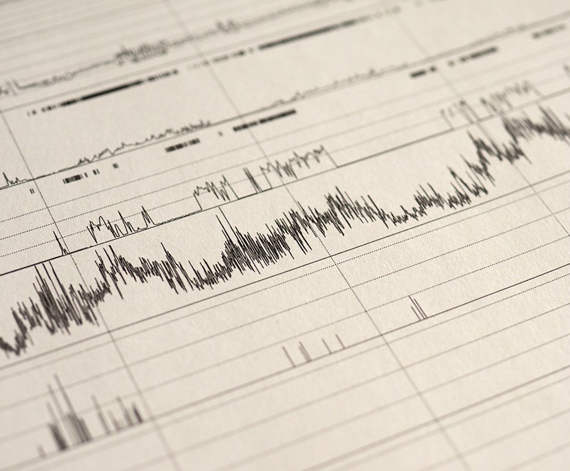 Data from a sleep test