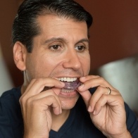 Man placing an oral appliance
