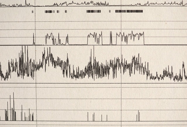 Sleep test recordings