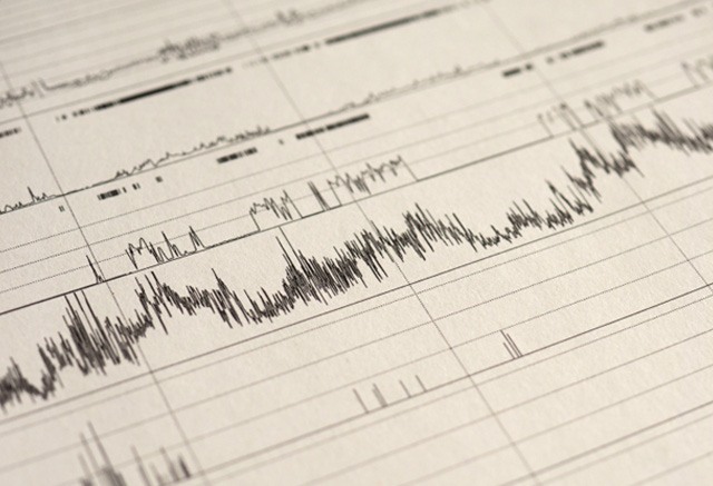 Results of sleep testing