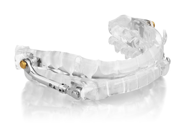 PH Herbst oral appliance