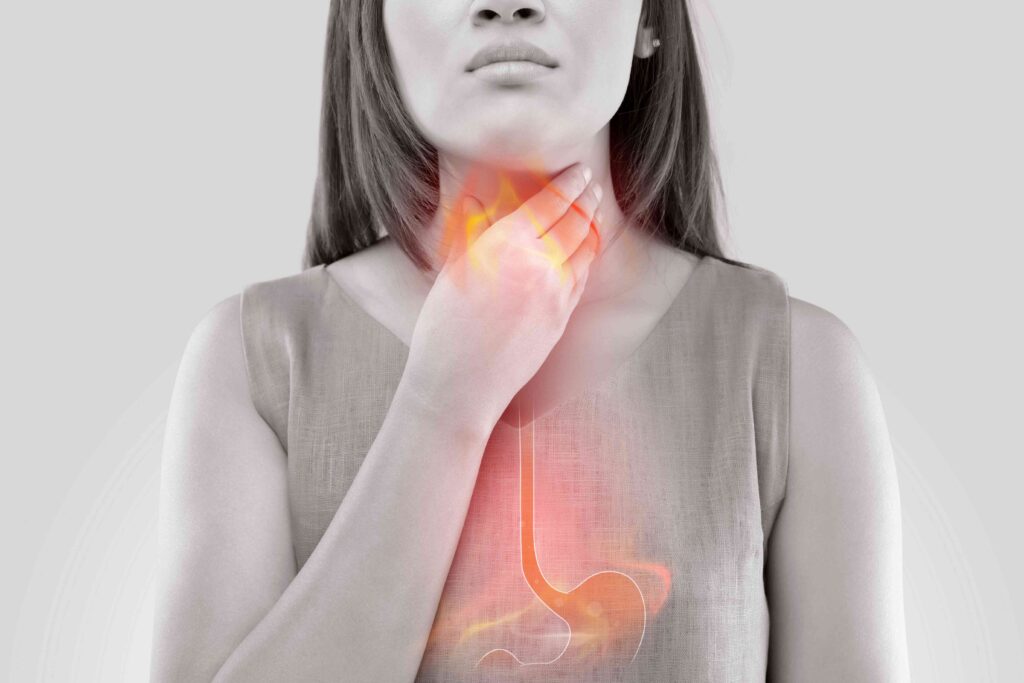 Woman with acid reflux