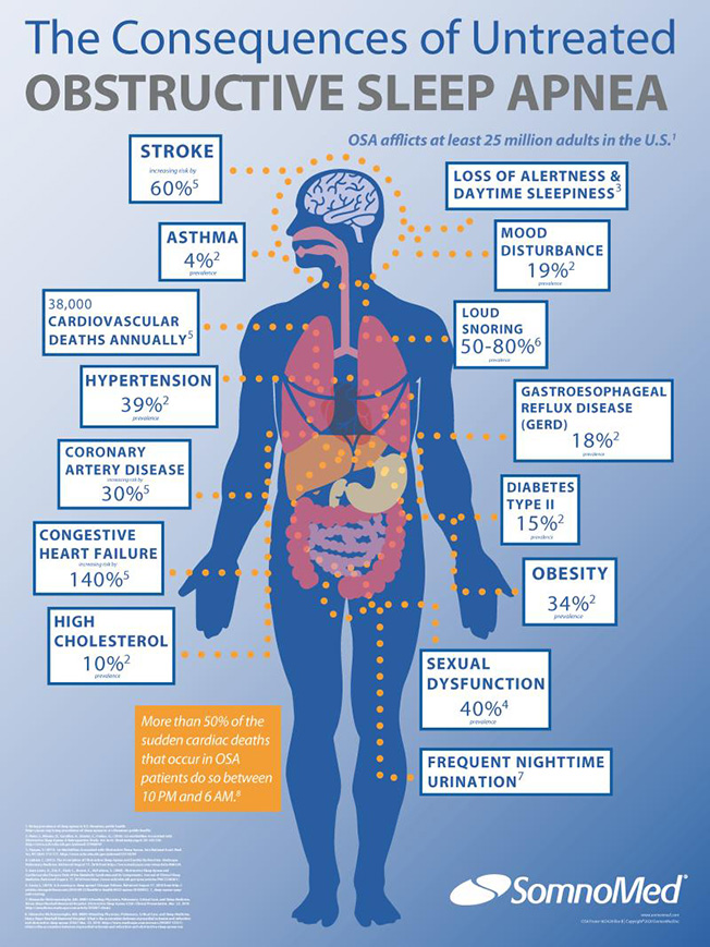Sleep Apnea Poster